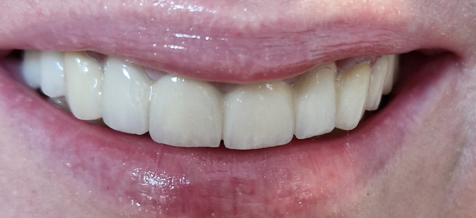 Dental Krišto