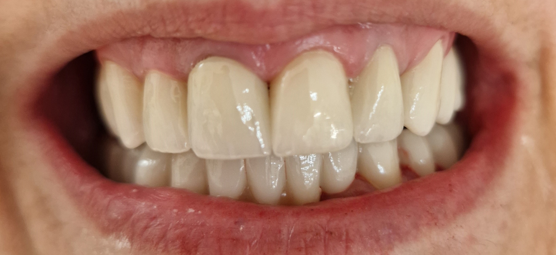 Dental Krišto