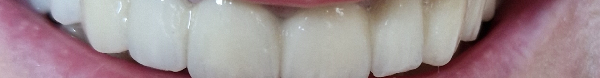 Dental Krišto