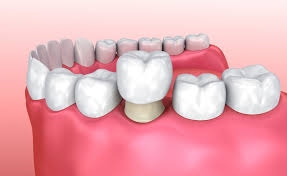Dental Krišto
